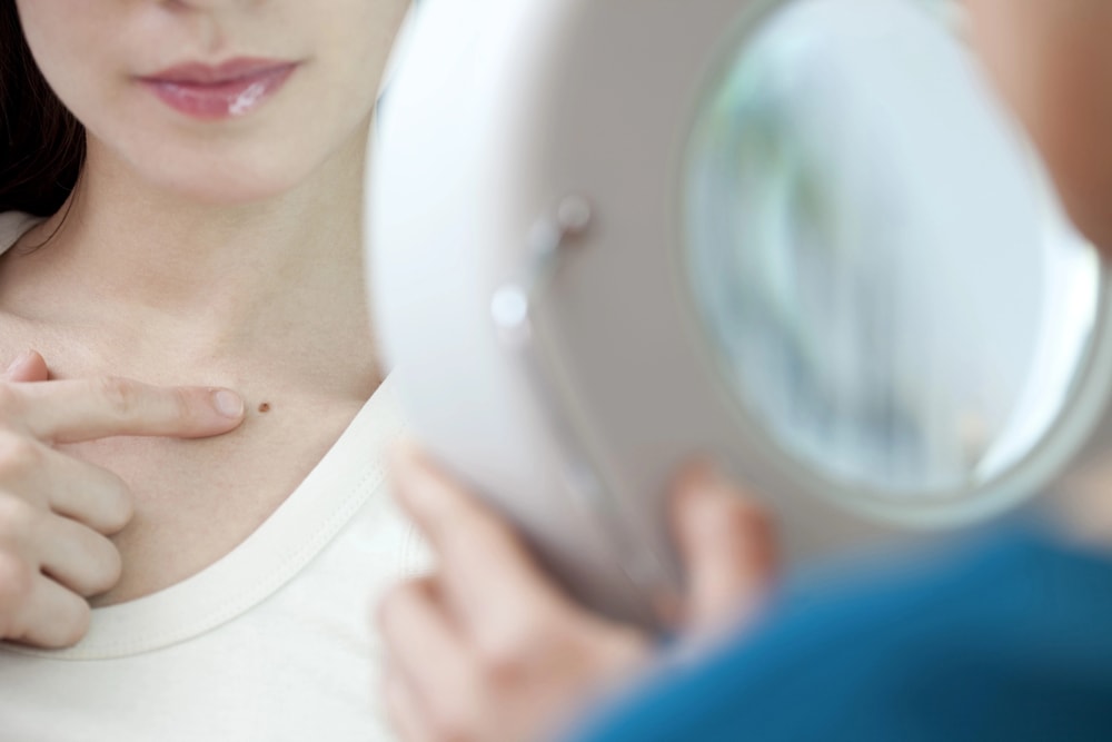 skin cancer screening guidelines