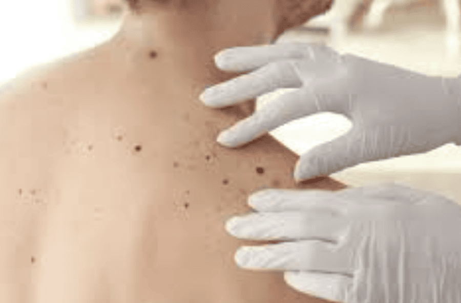 what cancer causes itchy skin